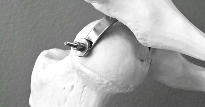 What's Going On When Your Hips Are Making Noise? image